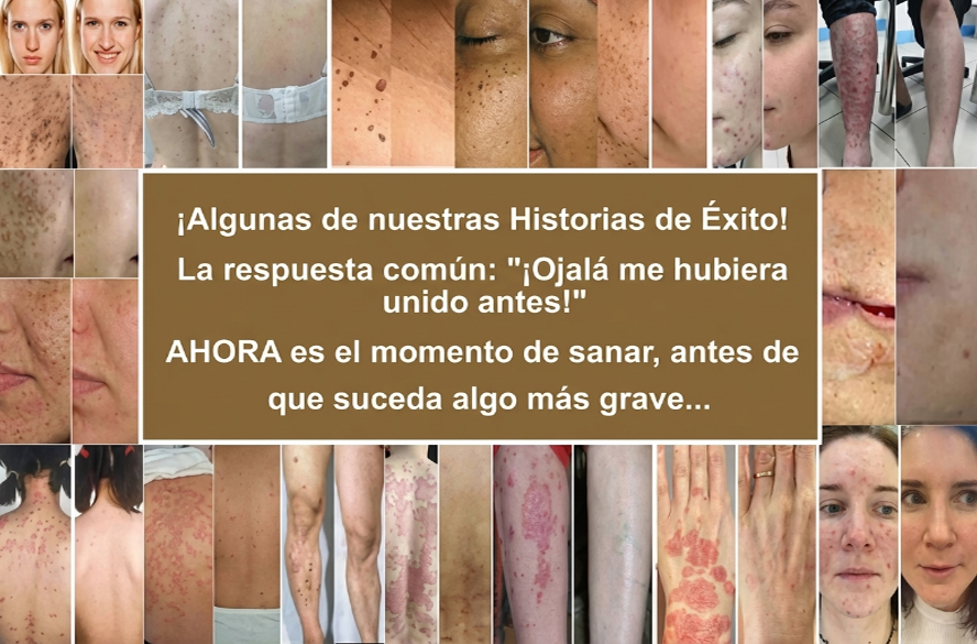 Pureluxo® CremaBlancoCalmante y Regeneradora de Arroz NegroY  (Para el tratamiento de verrugas, crecimientos cutáneos, imperfecciones e hiperpigmentación)
