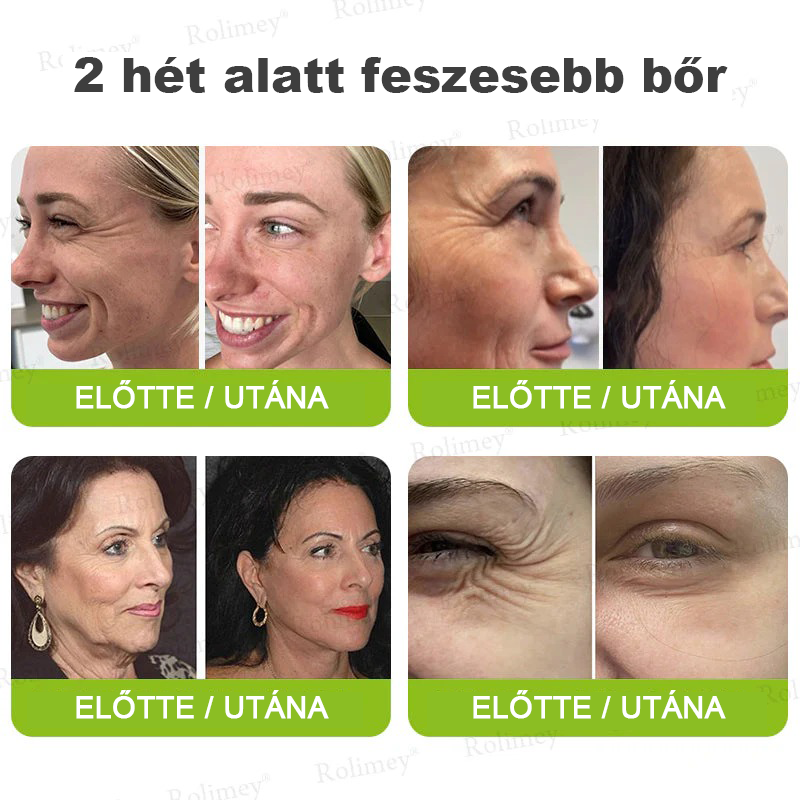 🌸Rolimey® Crema reafirmante antiarrugas con Botox y Vita-A Retinol Shot ⏰¡Último día! 70% de descuento💡