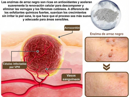 Pureluxo® CremaBlancoCalmante y Regeneradora de Arroz NegroY  (Para el tratamiento de verrugas, crecimientos cutáneos, imperfecciones e hiperpigmentación)