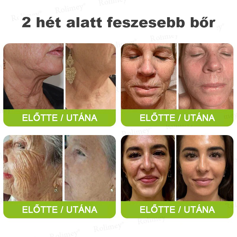 🌸Rolimey® Crema reafirmante antiarrugas con Botox y Vita-A Retinol Shot ⏰¡Último día! 70% de descuento💡