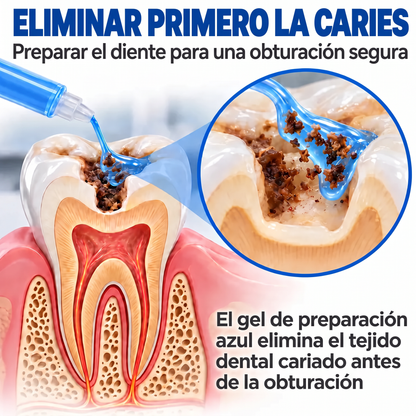 Glimmerly® Sistema DentRestore de reparación y relleno dental💥