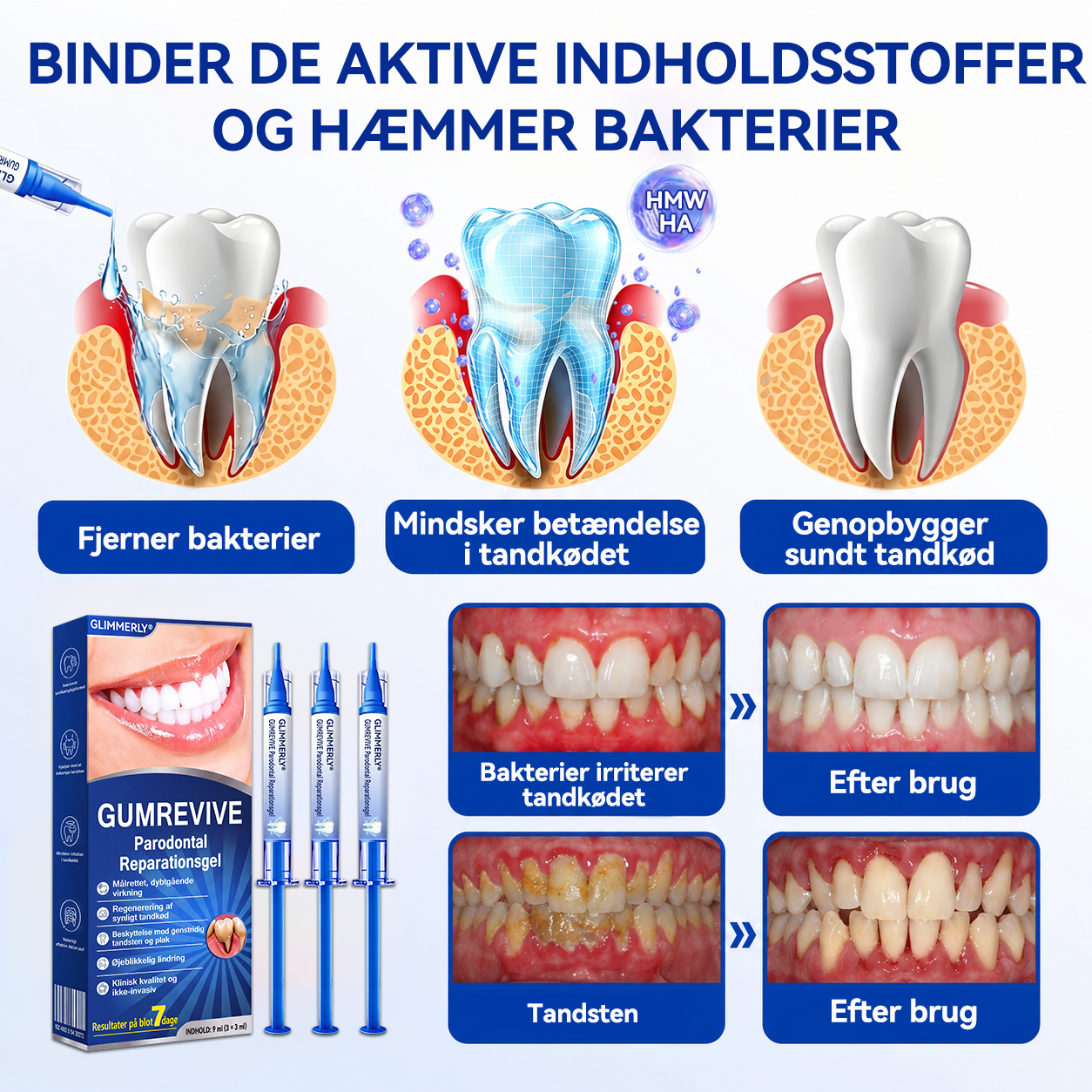 👩‍⚕️🎟️𝑮𝒍𝒊𝒎𝒎𝒆𝒓𝒍𝒚®🦷𝑮𝒖𝒎𝑹𝒆𝒗𝒊𝒗𝒆 𝑮𝒆𝒍 𝒅𝒆 𝑹𝒆𝒑𝒂𝒓𝒂𝒄𝒊ó𝒏 𝑷𝒂𝒓𝒐𝒅𝒐𝒏𝒕𝒂𝒍🦢