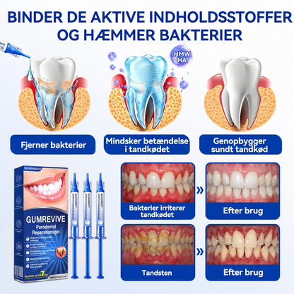👩‍⚕️🎟️𝑮𝒍𝒊𝒎𝒎𝒆𝒓𝒍𝒚®🦷𝑮𝒖𝒎𝑹𝒆𝒗𝒊𝒗𝒆 𝑮𝒆𝒍 𝒅𝒆 𝑹𝒆𝒑𝒂𝒓𝒂𝒄𝒊ó𝒏 𝑷𝒂𝒓𝒐𝒅𝒐𝒏𝒕𝒂𝒍🦢