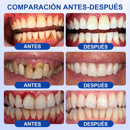 👩‍⚕️🎟️𝑮𝒍𝒊𝒎𝒎𝒆𝒓𝒍𝒚®🦷𝑮𝒖𝒎𝑹𝒆𝒗𝒊𝒗𝒆 𝑮𝒆𝒍 𝒅𝒆 𝑹𝒆𝒑𝒂𝒓𝒂𝒄𝒊ó𝒏 𝑷𝒂𝒓𝒐𝒅𝒐𝒏𝒕𝒂𝒍🎧