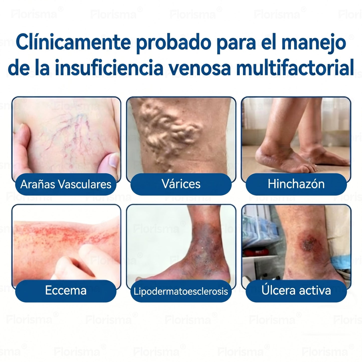 Un parche al día. Alivio visible de las venas en solo 7 días🍃 𝑭𝑳𝑶𝑹𝑰𝑺𝑴𝑨® 𝑫𝑰𝑶𝑺𝑴𝑰𝑵 & 𝑯𝑬𝑺𝑷𝑬𝑹𝑰𝑫𝑰𝑵 𝑪𝒍𝒊𝒏𝒊𝒄𝒂𝒍-𝑮𝒓𝒂𝒅𝒆 𝑭𝒐𝒓𝒎𝒖𝒍𝒂 𝑴𝒊𝒄𝒓𝒐𝒏𝒆𝒆𝒅𝒍𝒆 𝑷𝒂𝒕𝒄𝒉💌