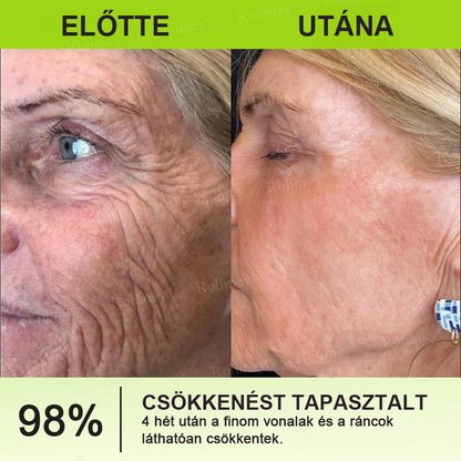 🌸Rolimey® Crema reafirmante antiarrugas con Botox y Vita-A Retinol Shot ⏰¡Último día! 70% de descuento💡