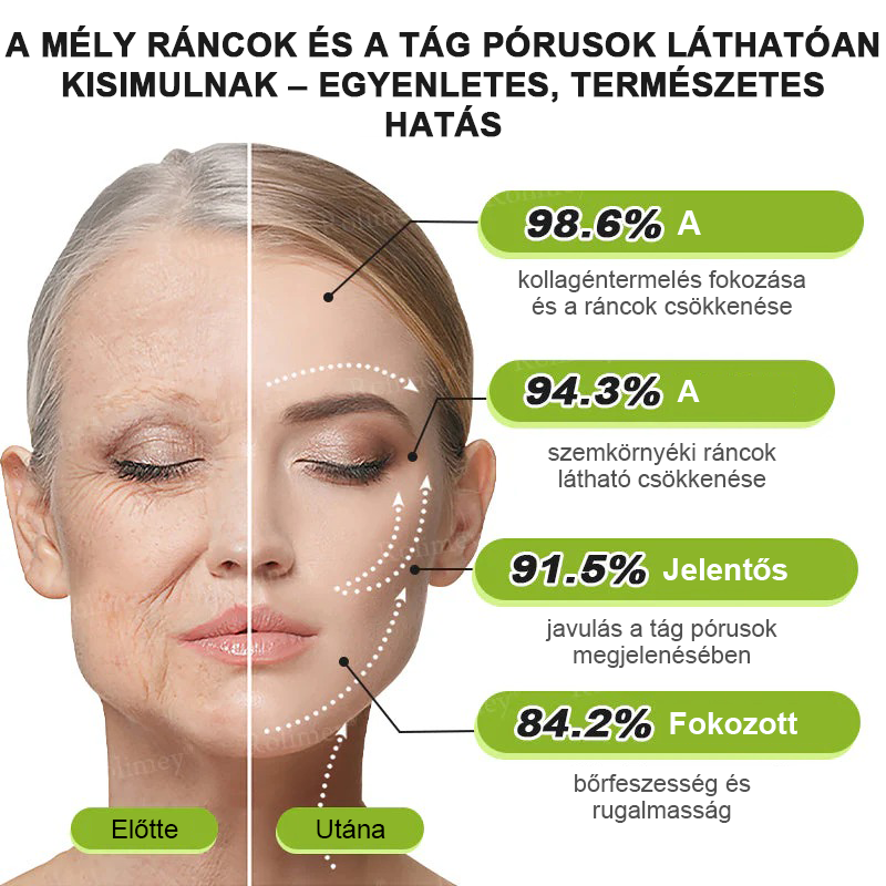 🌸Rolimey® Crema reafirmante antiarrugas con Botox y Vita-A Retinol Shot ⏰¡Último día! 70% de descuento💡