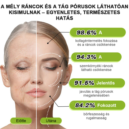 🌸Rolimey® Crema reafirmante antiarrugas con Botox y Vita-A Retinol Shot ⏰¡Último día! 70% de descuento💡