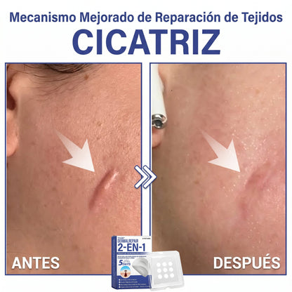 🔥Timilk®DermalRepair Parche de Microagujas y Mancha de Hidrocoloide 2 en 1 💉| Eliminador de lunares elevados, acné, verrugas planas y fibromas cutáneos | Mejora arrugas, cicatrices e imperfecciones | Parches invisibles para granos (rostro y cuerpo)💫