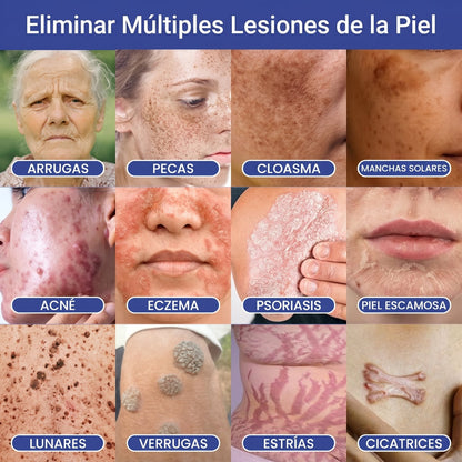 🔥Timilk®DermalRepair Parche de Microagujas y Mancha de Hidrocoloide 2 en 1 💉| Eliminador de lunares elevados, acné, verrugas planas y fibromas cutáneos | Mejora arrugas, cicatrices e imperfecciones | Parches invisibles para granos (rostro y cuerpo)💫