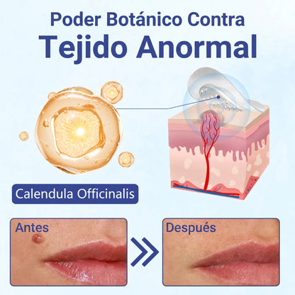 🔥Timilk®DermalRepair Parche de Microagujas y Mancha de Hidrocoloide 2 en 1 💉| Eliminador de lunares elevados, acné, verrugas planas y fibromas cutáneos | Mejora arrugas, cicatrices e imperfecciones | Parches invisibles para granos (rostro y cuerpo)💫