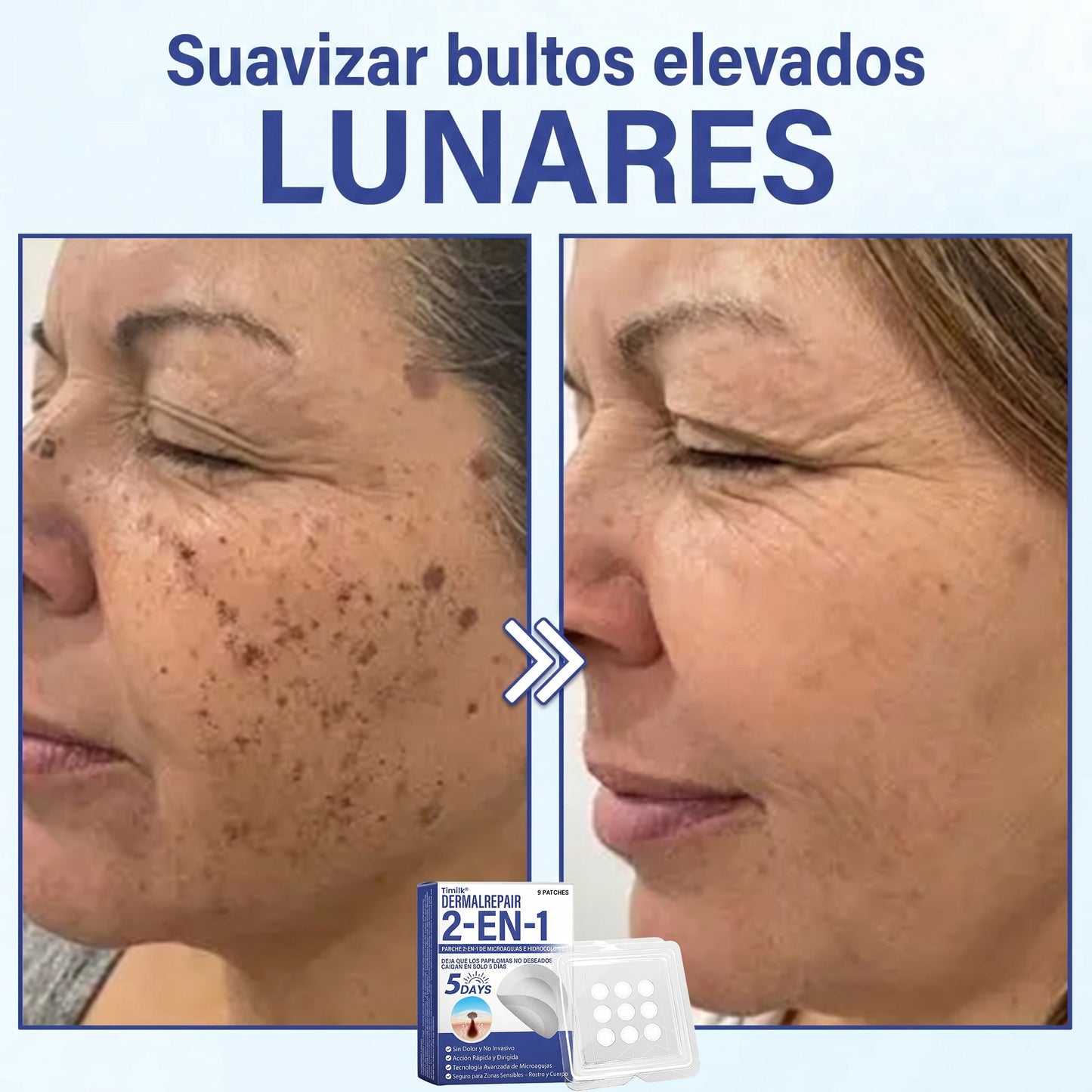 🔥Timilk®DermalRepair Parche de Microagujas y Mancha de Hidrocoloide 2 en 1 💉| Eliminador de lunares elevados, acné, verrugas planas y fibromas cutáneos | Mejora arrugas, cicatrices e imperfecciones | Parches invisibles para granos (rostro y cuerpo)💫