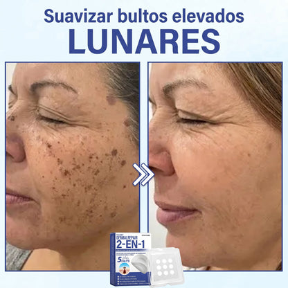 🔥Timilk®DermalRepair Parche de Microagujas y Mancha de Hidrocoloide 2 en 1 💉| Eliminador de lunares elevados, acné, verrugas planas y fibromas cutáneos | Mejora arrugas, cicatrices e imperfecciones | Parches invisibles para granos (rostro y cuerpo)💫
