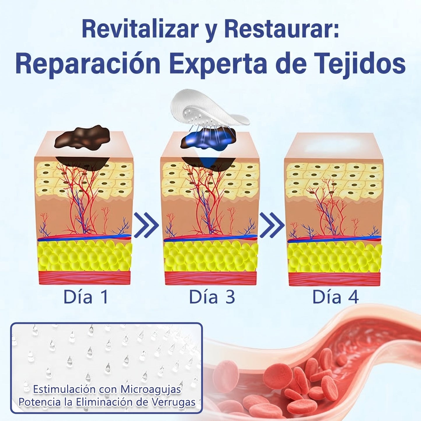 🔥Timilk®DermalRepair Parche de Microagujas y Mancha de Hidrocoloide 2 en 1 💉| Eliminador de lunares elevados, acné, verrugas planas y fibromas cutáneos | Mejora arrugas, cicatrices e imperfecciones | Parches invisibles para granos (rostro y cuerpo)💫