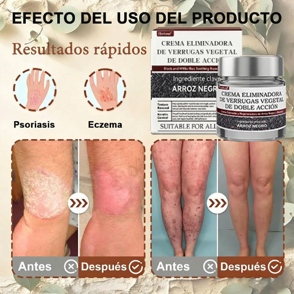 Pureluxo® CremaBlancoCalmante y Regeneradora de Arroz NegroY  (Para el tratamiento de verrugas, crecimientos cutáneos, imperfecciones e hiperpigmentación)