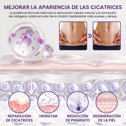 Timilk® ReGenScar Gel para cicatrices con células madre
