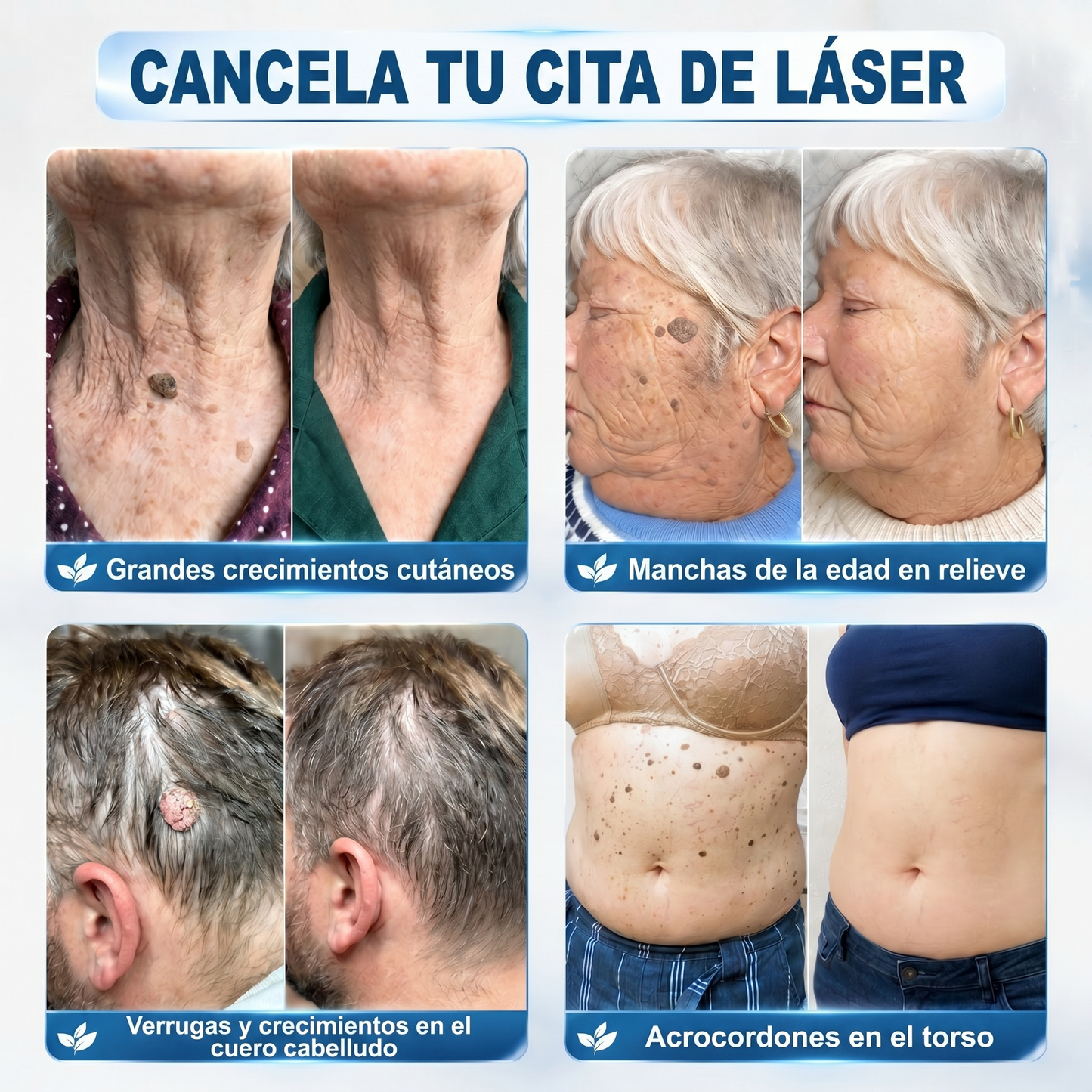 𝐏𝐢𝐜𝐝𝐨® 𝐁𝐨𝐫𝐫𝐚𝐝𝐨𝐫 𝐝𝐞 𝐕𝐞𝐫𝐫𝐮𝐠𝐚𝐬 𝐲 𝐌𝐚𝐧𝐜𝐡𝐚𝐬 𝐝𝐞 𝟕 𝐃í𝐚𝐬(Aplicador roll-on: sin dolor ni cicatrices)🐾