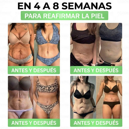 𝑳𝒖𝒙𝒂𝒓𝒊𝒔𝒆® 🥑 Moringa & Berberina 10 en 1 Parche Avanzado de Microagujas Nano (Uso diario, cambios visibles en 7 días) 👩‍⚕️ Obesidad, Diabetes, Apnea del Sueño y Problemas Articulares