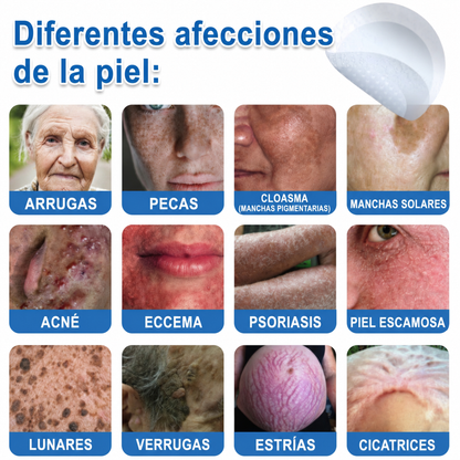 👩‍⚕️ Glimmerly® Parche 2 en 1 de microagujas e hidrocoloide | Eliminador de lunares en relieve, acné, verrugas planas y acrocordones | Mejora arrugas, cicatrices e imperfecciones | Parches invisibles para granos (rostro y cuerpo) | 144 unidades 🎁
