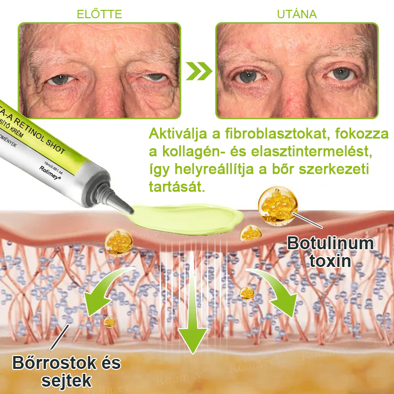 🌸Rolimey® Crema reafirmante antiarrugas con Botox y Vita-A Retinol Shot ⏰¡Último día! 70% de descuento💡