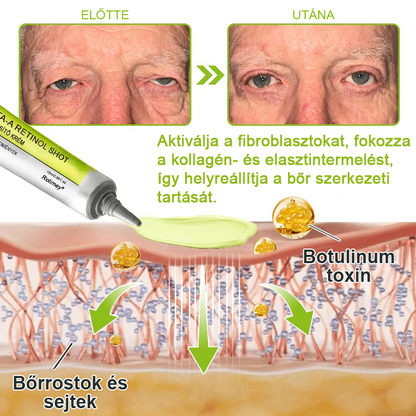 🌸Rolimey® Crema reafirmante antiarrugas con Botox y Vita-A Retinol Shot ⏰¡Último día! 70% de descuento💡