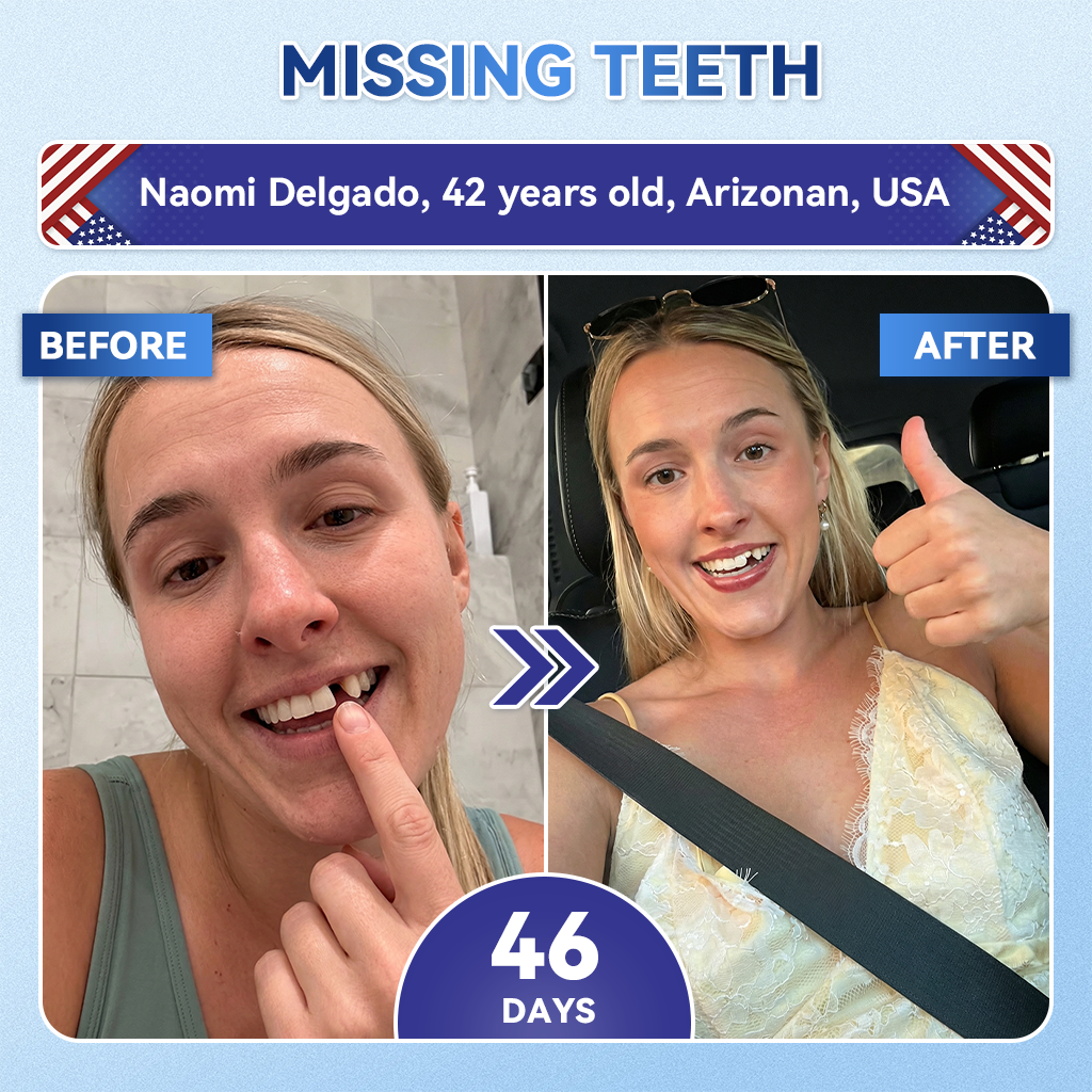 🦷𝐆𝐥𝐢𝐦𝐦𝐞𝐫𝐥𝐲®Parche de microagujas con Tideglusib para la reparación de dientes y encías  3.0