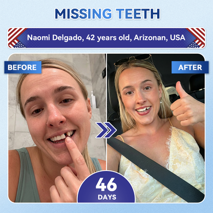 🦷𝐆𝐥𝐢𝐦𝐦𝐞𝐫𝐥𝐲®Parche de microagujas con Tideglusib para la reparación de dientes y encías  3.0