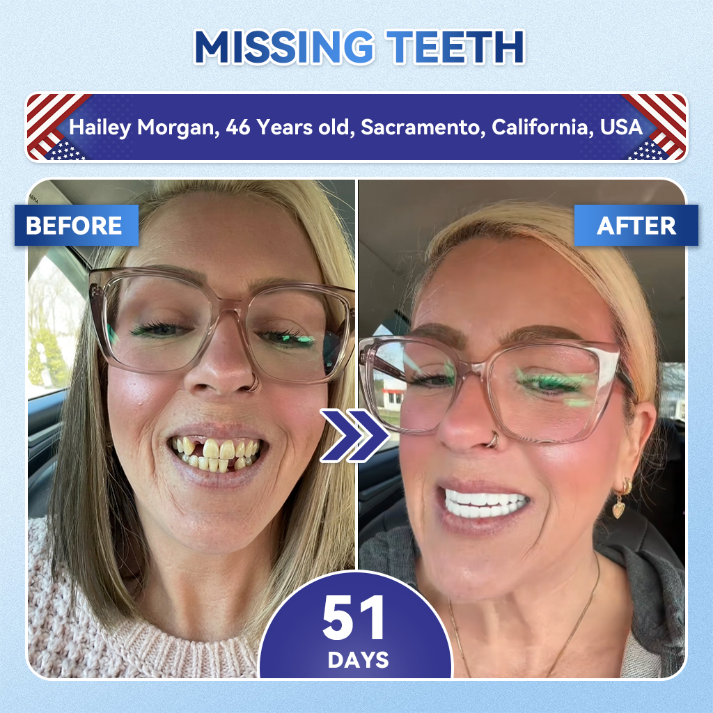 🦷𝐆𝐥𝐢𝐦𝐦𝐞𝐫𝐥𝐲®Parche de microagujas con Tideglusib para la reparación de dientes y encías  3.0