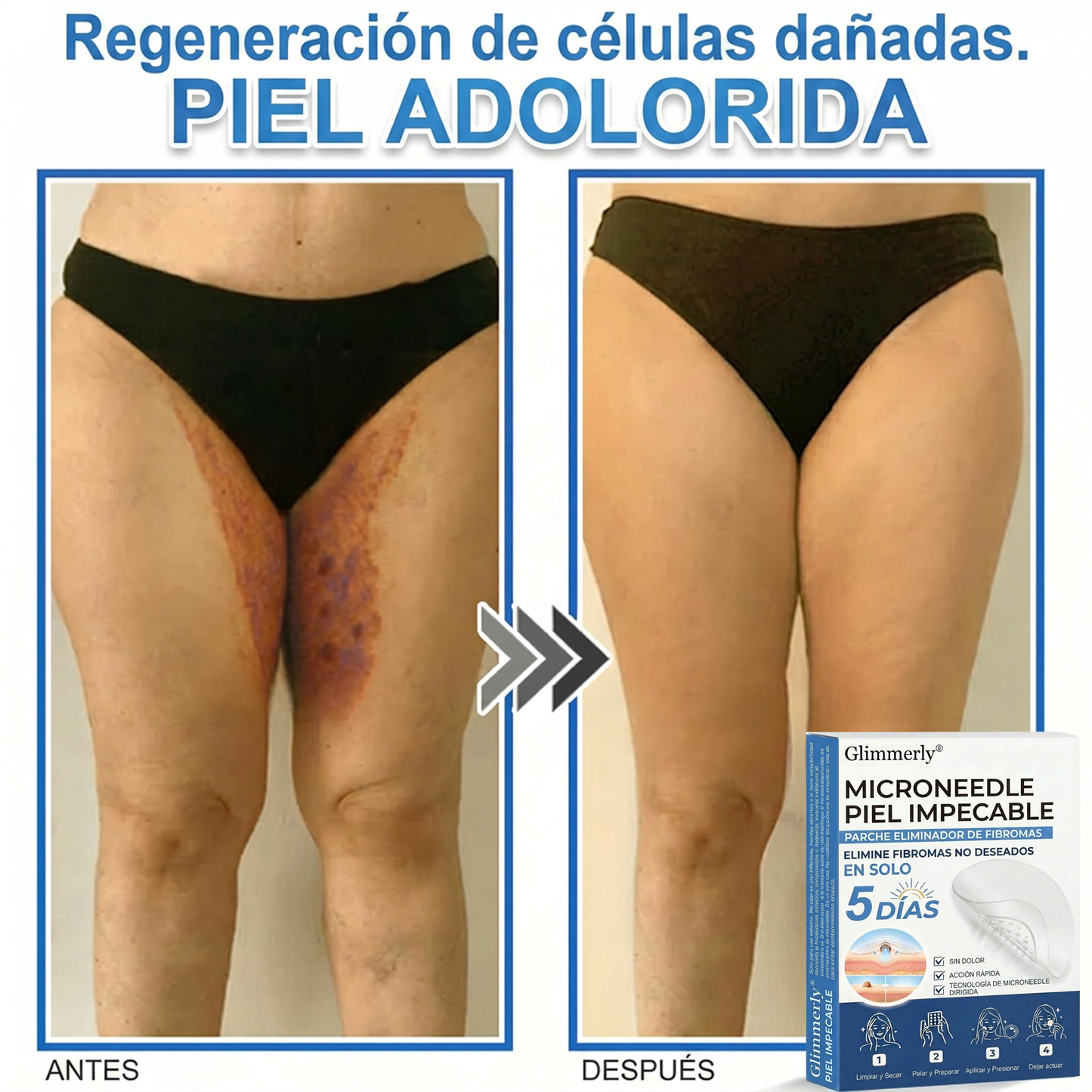 👩‍⚕️ Glimmerly® Parche 2 en 1 de microagujas e hidrocoloide | Eliminador de lunares en relieve, acné, verrugas planas y acrocordones | Mejora arrugas, cicatrices e imperfecciones | Parches invisibles para granos (rostro y cuerpo) | 144 unidades 🎁