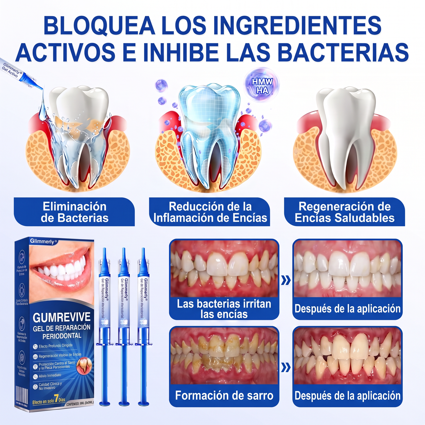 👩‍⚕️🎟️𝑮𝒍𝒊𝒎𝒎𝒆𝒓𝒍𝒚®🦷𝑮𝒖𝒎𝑹𝒆𝒗𝒊𝒗𝒆 𝑮𝒆𝒍 𝒅𝒆 𝑹𝒆𝒑𝒂𝒓𝒂𝒄𝒊ó𝒏 𝑷𝒂𝒓𝒐𝒅𝒐𝒏𝒕𝒂𝒍🎧