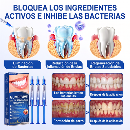 👩‍⚕️🎟️𝑮𝒍𝒊𝒎𝒎𝒆𝒓𝒍𝒚®🦷𝑮𝒖𝒎𝑹𝒆𝒗𝒊𝒗𝒆 𝑮𝒆𝒍 𝒅𝒆 𝑹𝒆𝒑𝒂𝒓𝒂𝒄𝒊ó𝒏 𝑷𝒂𝒓𝒐𝒅𝒐𝒏𝒕𝒂𝒍🎧