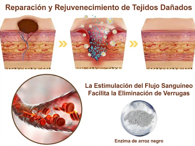 Pureluxo® CremaBlancoCalmante y Regeneradora de Arroz NegroY  (Para el tratamiento de verrugas, crecimientos cutáneos, imperfecciones e hiperpigmentación)