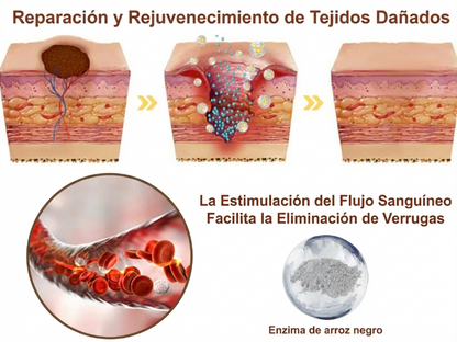 Pureluxo® CremaBlancoCalmante y Regeneradora de Arroz NegroY  (Para el tratamiento de verrugas, crecimientos cutáneos, imperfecciones e hiperpigmentación)