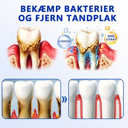 👩‍⚕️🎟️𝑮𝒍𝒊𝒎𝒎𝒆𝒓𝒍𝒚®🦷𝑮𝒖𝒎𝑹𝒆𝒗𝒊𝒗𝒆 𝑮𝒆𝒍 𝒅𝒆 𝑹𝒆𝒑𝒂𝒓𝒂𝒄𝒊ó𝒏 𝑷𝒂𝒓𝒐𝒅𝒐𝒏𝒕𝒂𝒍🦢