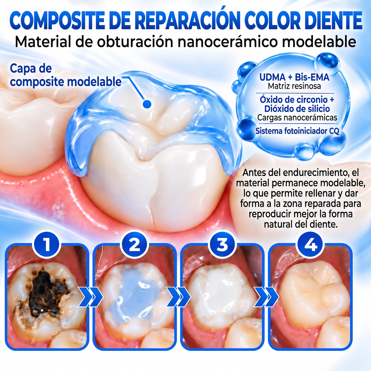Glimmerly® Sistema DentRestore de reparación y relleno dental💥
