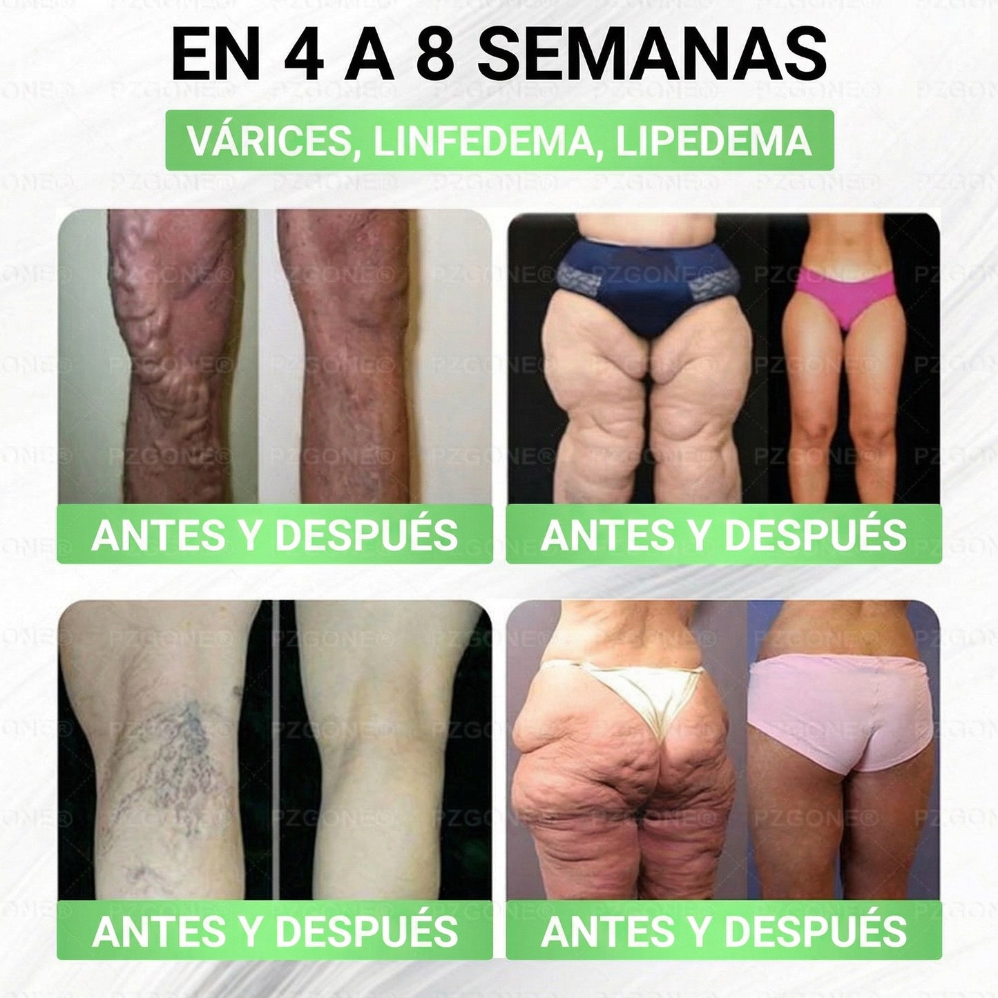 𝑳𝒖𝒙𝒂𝒓𝒊𝒔𝒆® 🥑 Moringa & Berberina 10 en 1 Parche Avanzado de Microagujas Nano (Uso diario, cambios visibles en 7 días) 👩‍⚕️ Obesidad, Diabetes, Apnea del Sueño y Problemas Articulares
