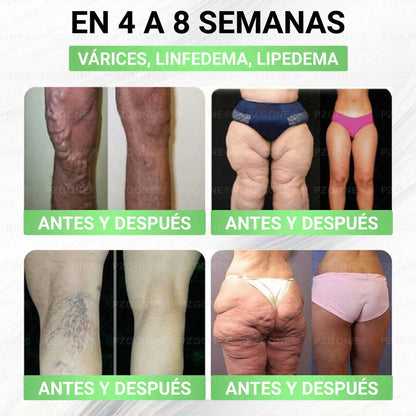 𝑳𝒖𝒙𝒂𝒓𝒊𝒔𝒆® 🥑 Moringa & Berberina 10 en 1 Parche Avanzado de Microagujas Nano (Uso diario, cambios visibles en 7 días) 👩‍⚕️ Obesidad, Diabetes, Apnea del Sueño y Problemas Articulares