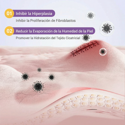 ✅Tienda oficial |BBOJI®ÁCIDO HIALURÓNICO CINTA DE REPARACIÓN DE NANO MICROMUJAS 🏥(Tratamiento de cicatrices antiguas y recientes, reducción de cicatrices quirúrgicas, estrías, queloides, acné, quemaduras, verrugas, dermatomas y varices)