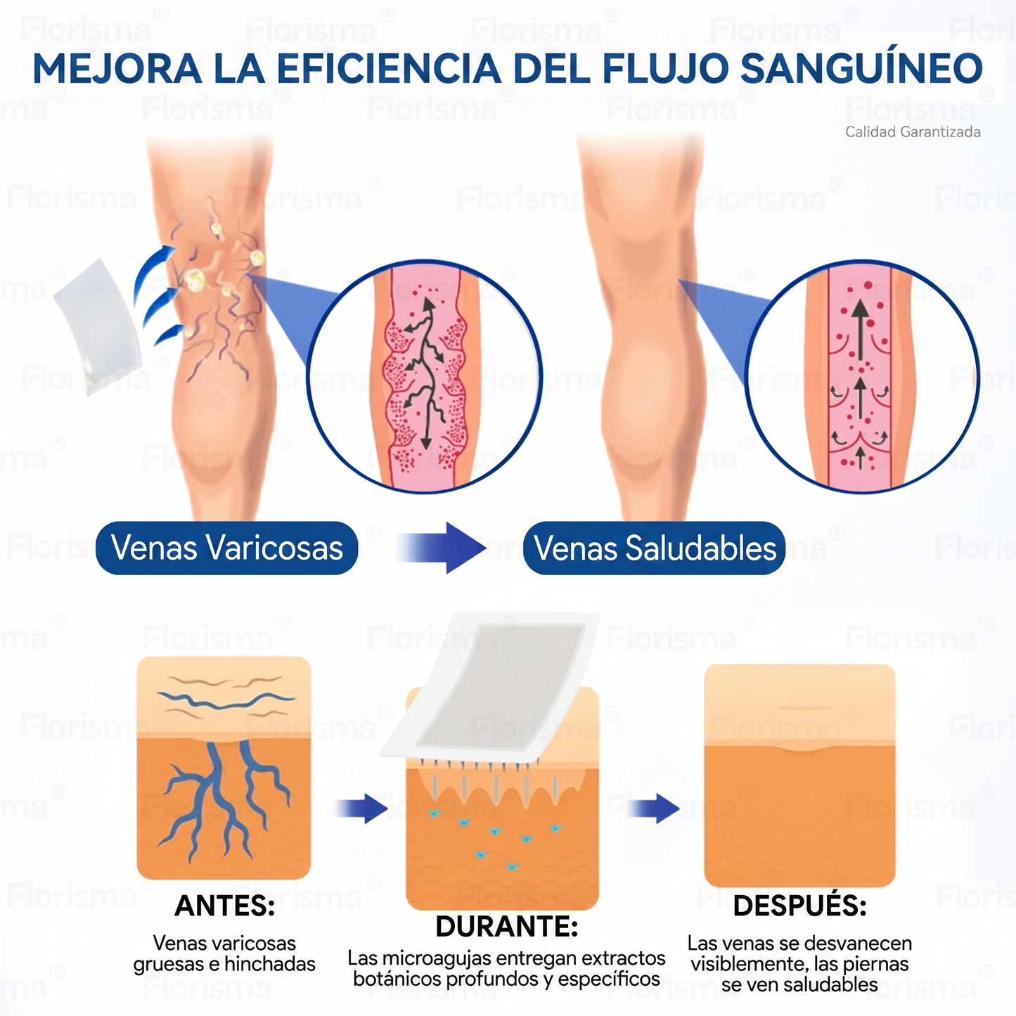 Un parche al día. Alivio visible de las venas en solo 7 días🍃 𝑭𝑳𝑶𝑹𝑰𝑺𝑴𝑨® 𝑫𝑰𝑶𝑺𝑴𝑰𝑵 & 𝑯𝑬𝑺𝑷𝑬𝑹𝑰𝑫𝑰𝑵 𝑪𝒍𝒊𝒏𝒊𝒄𝒂𝒍-𝑮𝒓𝒂𝒅𝒆 𝑭𝒐𝒓𝒎𝒖𝒍𝒂 𝑴𝒊𝒄𝒓𝒐𝒏𝒆𝒆𝒅𝒍𝒆 𝑷𝒂𝒕𝒄𝒉💌