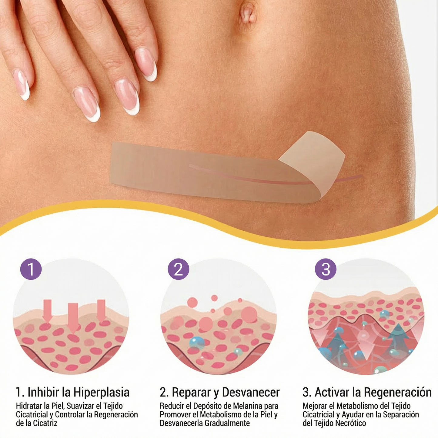 ✅Tienda oficial |BBOJI®ÁCIDO HIALURÓNICO CINTA DE REPARACIÓN DE NANO MICROMUJAS 🏥(Tratamiento de cicatrices antiguas y recientes, reducción de cicatrices quirúrgicas, estrías, queloides, acné, quemaduras, verrugas, dermatomas y varices)
