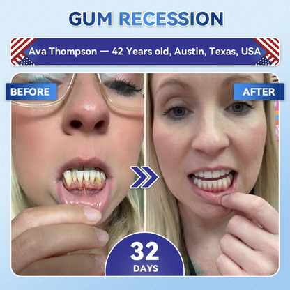 🦷𝐆𝐥𝐢𝐦𝐦𝐞𝐫𝐥𝐲®Parche de microagujas con Tideglusib para la reparación de dientes y encías  3.0